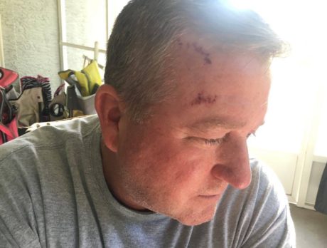 Injured K-9 deputy recalls being struck by motorcycle