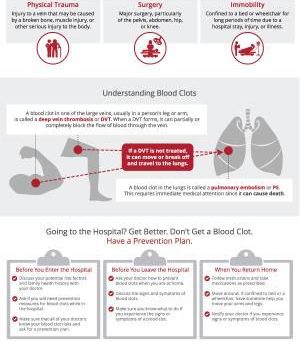 Tips to Prevent Blood Clots During Hospital Stays