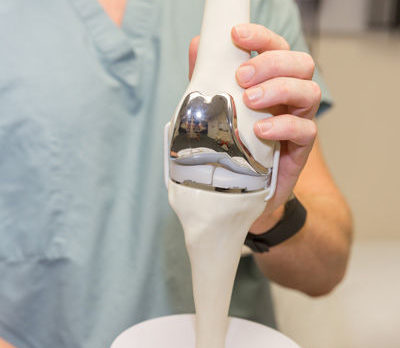 Are custom-built replacement knees the next thing?