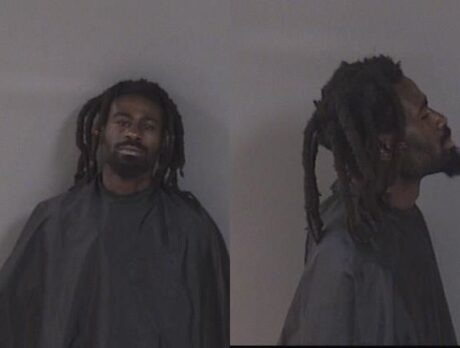 Man to undergo surgery after robbery attack; another charged